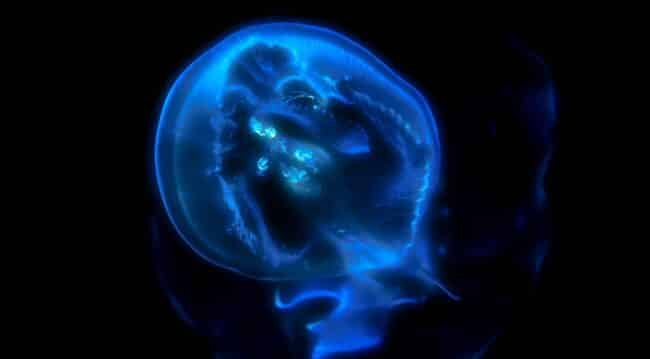 brain scan