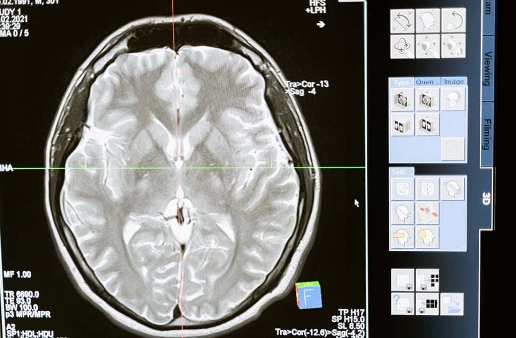 brain scan
